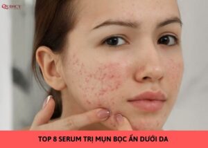 serum trị mụn bọc
