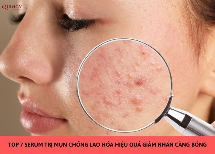 serum trị mụn chống lão hóa