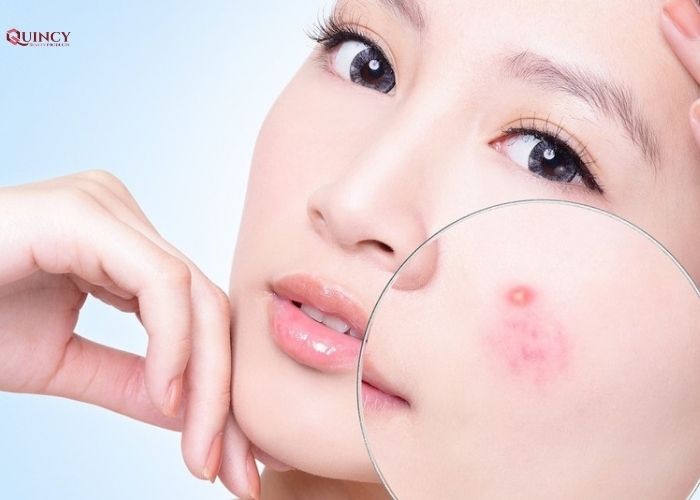Uống nước nóng hằng ngày có lợi ích gì? 12 uống nước nóng
