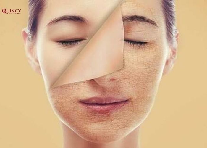 Uống nước nóng hằng ngày có lợi ích gì? 17 uống nước nóng