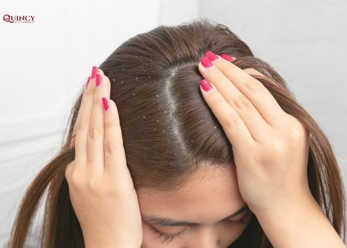 Uống nước nóng hằng ngày có lợi ích gì? 18 uống nước nóng