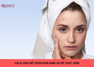 cách làm hết mụn