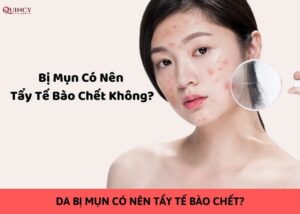 da bị mụn có nên tẩy tế bào chết
