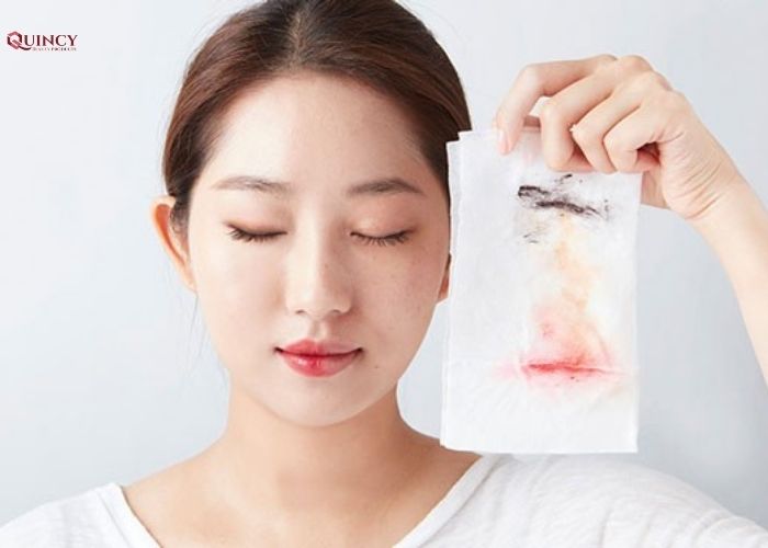 Phương pháp điều trị da mặt sần sùi nhiều mụn cám 11 da mặt sần sùi nhiều mụn cám