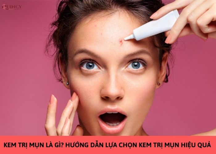 kem trị mụn là gì