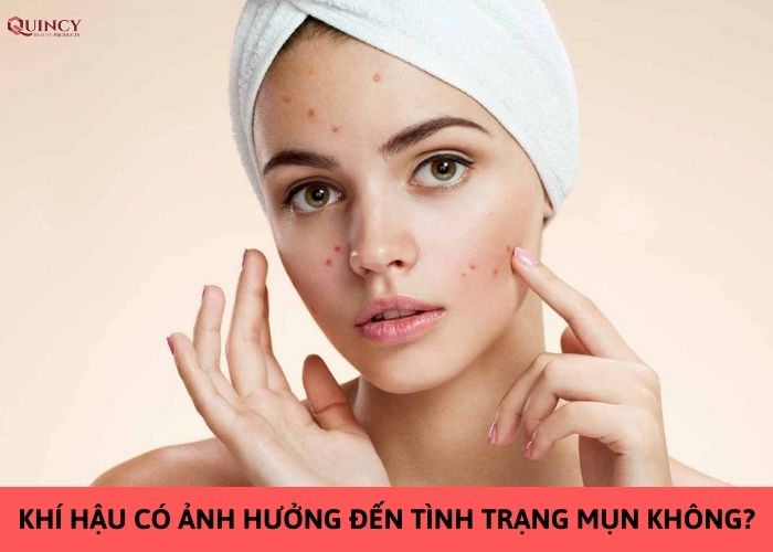 khí hậu có ảnh hưởng đến tình trạng mụn không