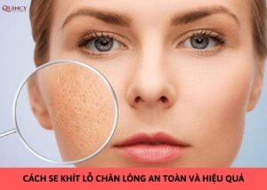 se khít lỗ chân lông