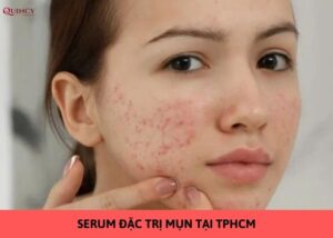 serum đặc trị mụn tại tphcm