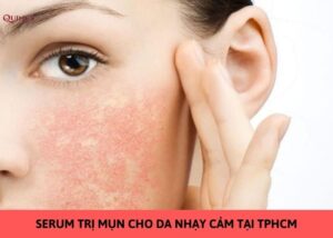 serum trị mụn cho da nhạy cảm tại tphcm
