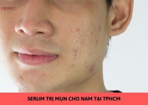 serum trị mụn cho nam tại tphcm