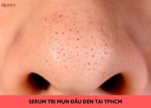 serum trị mụn đầu đen