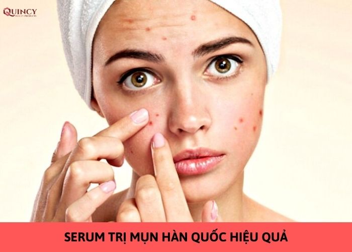 serum trị mụn hàn quốc hiệu quả