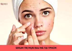 serum trị mụn rau má tại tphcm