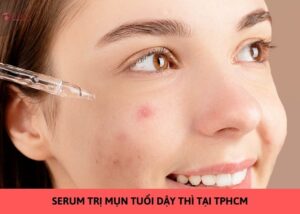 serum trị mụn tuổi dậy thì tại tphcm