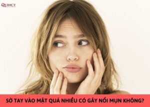 sờ tay vào mặt quá nhiều có gây nổi mụn không