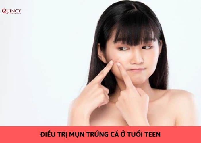 điều trị mụn trứng cá ở tuổi teen