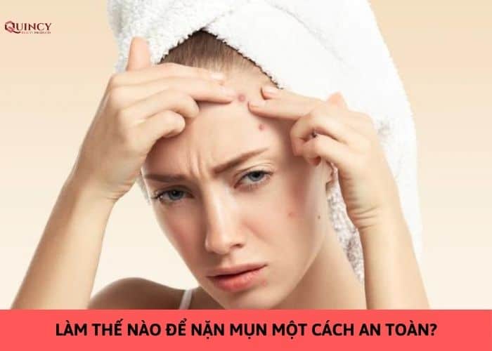 làm thế nào để nặn mụn một cách an toàn