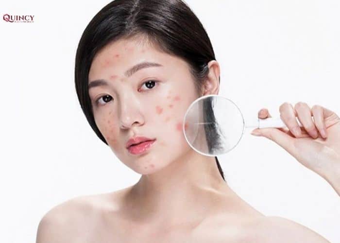 Tác dụng của dầu argan cho sức khỏe làn da 15 tác dụng của dầu argan