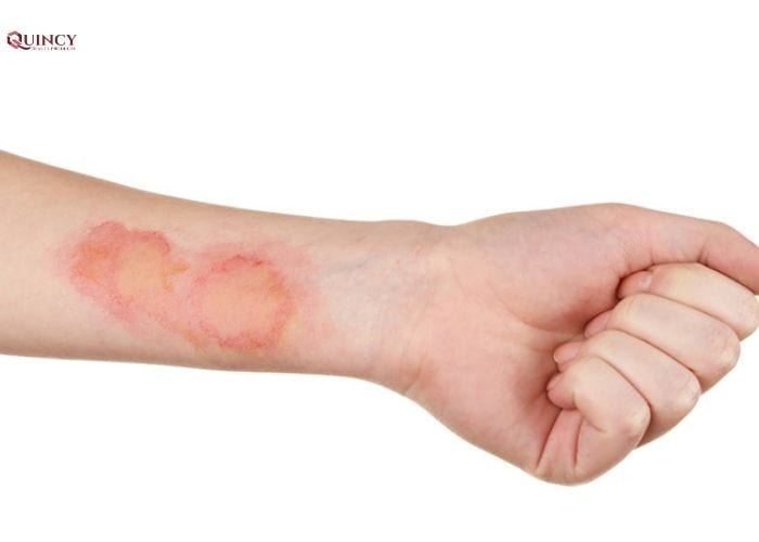 Tác dụng của dầu argan cho sức khỏe làn da 16 tác dụng của dầu argan
