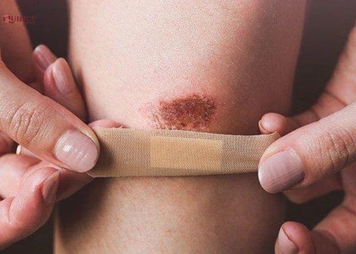 Tác dụng của dầu argan cho sức khỏe làn da 17 tác dụng của dầu argan