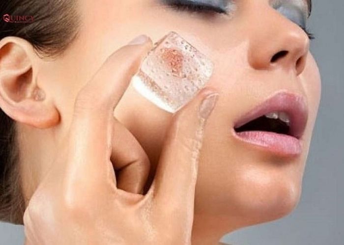 Trị mụn bằng đá lạnh có tốt không? 7 trị mụn bằng đá lạnh có tốt không
