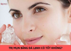 trị mụn bằng đá lạnh có tốt không