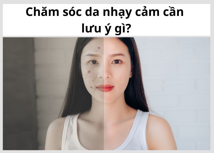  Chăm sóc Da Nhạy Cảm Cần Lưu Ý Gì?
