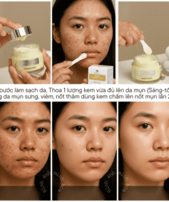 Kem hỗ trợ giảm mụn và làm sáng da Doctor care® 3 kem Doctor care 24