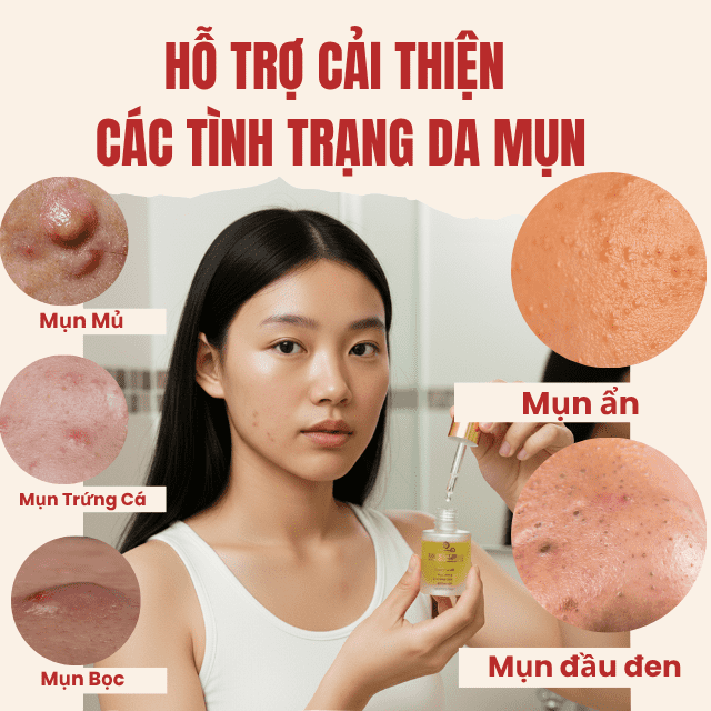 Tinh chất hỗ trợ giảm mụn Doctor care® Acnes Elimination 16 serum doctor care 1