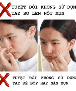 Tinh chất hỗ trợ giảm mụn Doctor care® Acnes Elimination 6 serum doctor care 18