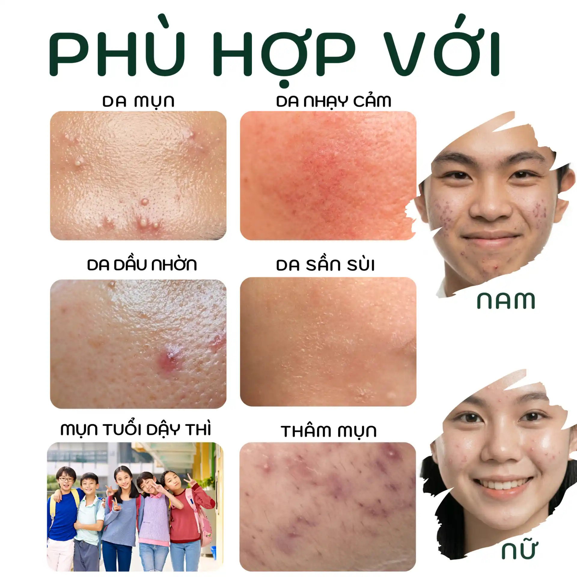 Serum Doctor care 7ml/20ml – Hỗ Trợ Chăm Sóc Da Dầu Dễ Nổi Mụn, Giảm Bã Nhờn, Sáng Da, Cấp Ẩm, Thấm Nhanh 15 serum doctor care 191 optimized