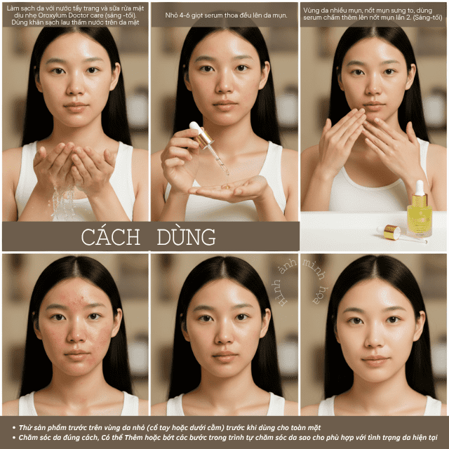 Tinh chất hỗ trợ giảm mụn Doctor care® Acnes Elimination 20 serum doctor care 64