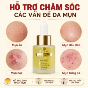 Ảnh trải nghiệm của thảo